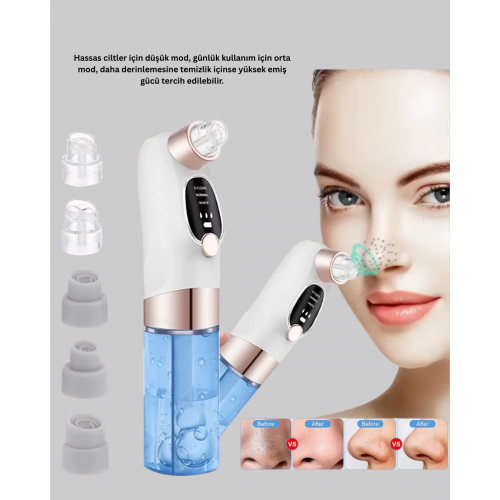 Ayarlanabilir Güç Seviyeli Vakumlu Siyah Nokta Temizleme Cihazı – Derin Gözenek Temizliği Ayarlanabilir Güç Seviyeli Vakumlu Siyah Nokta Temizleme Cihazı – Derin Gözenek Temizliği