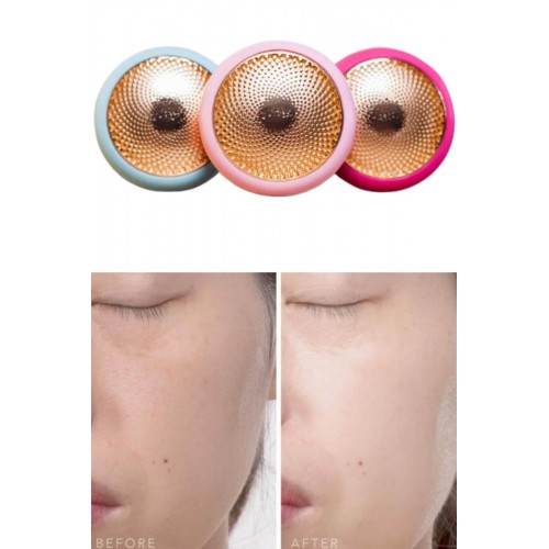 Mini Saç Derisi Masaj Aleti Led Işık Terapisi Cildi Yatıştırır ve Dengeler