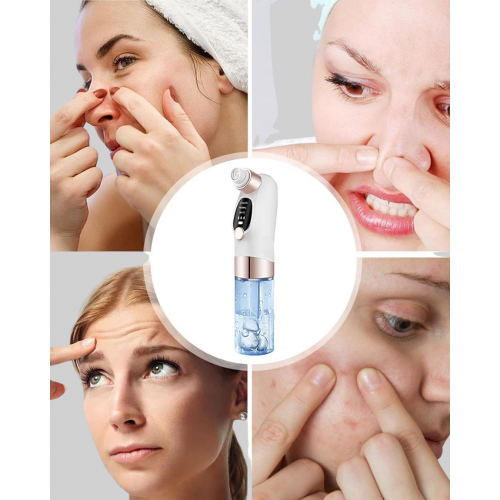Çok Fonksiyonlu Cilt Bakım Cihazı – Siyah Nokta Gözenek ve Akne Temizleyici