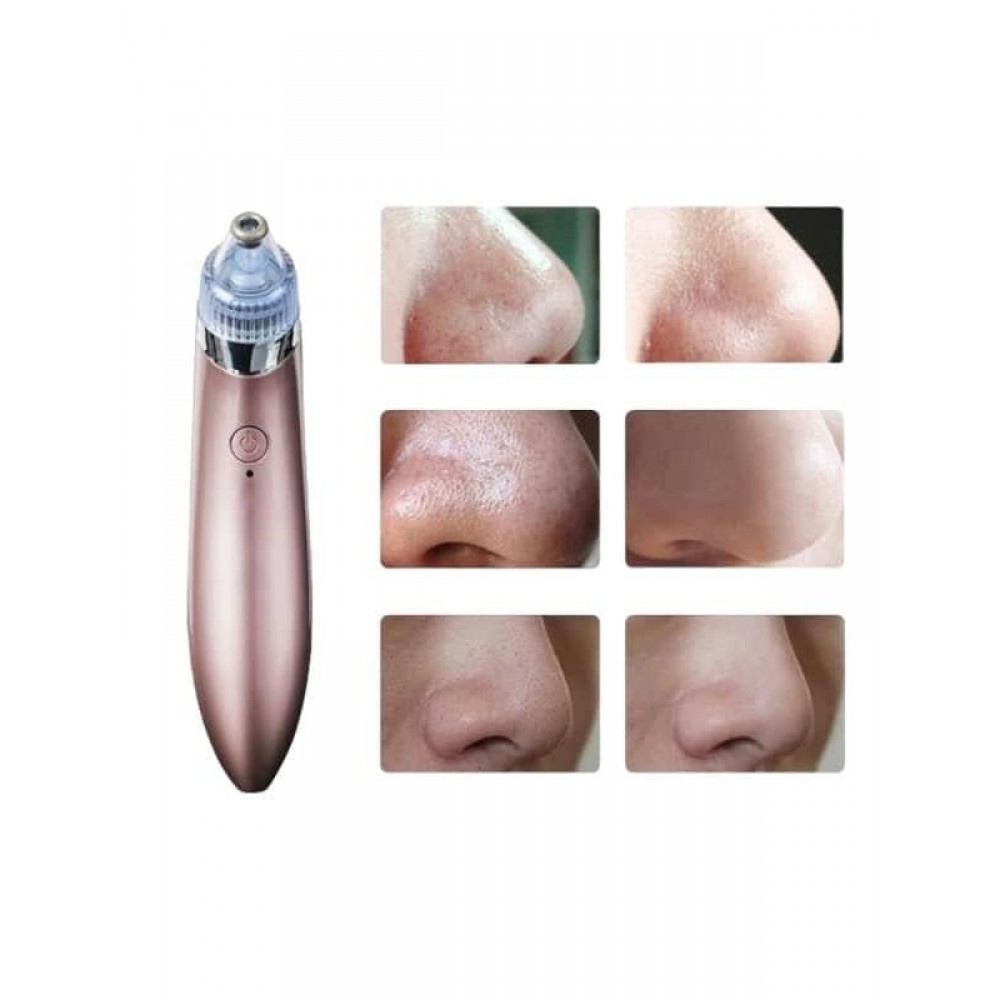 SİYAH NOKTA CİHAZI